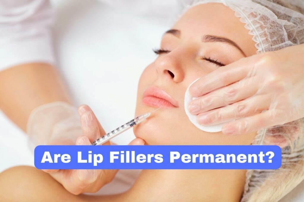 Are Lip Fillers Permanent?