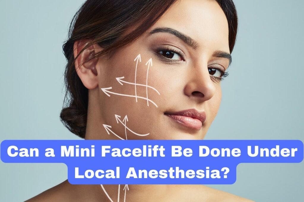 Can a Mini Facelift Be Done Under Local Anesthesia?