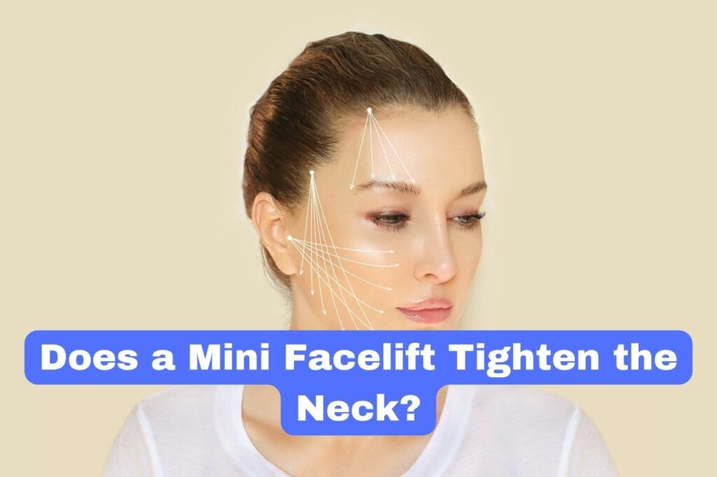 Does a Mini Facelift Tighten the Neck?