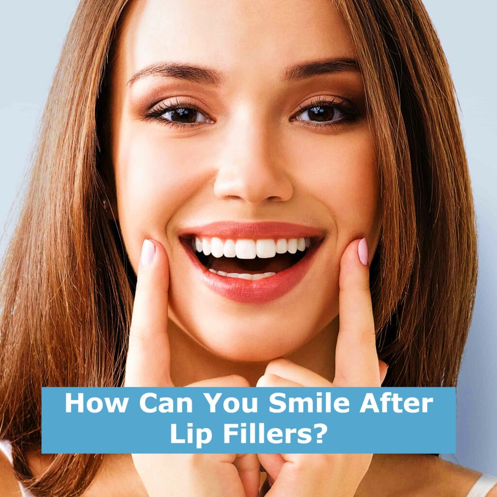 How Can You Smile After Lip Fillers?