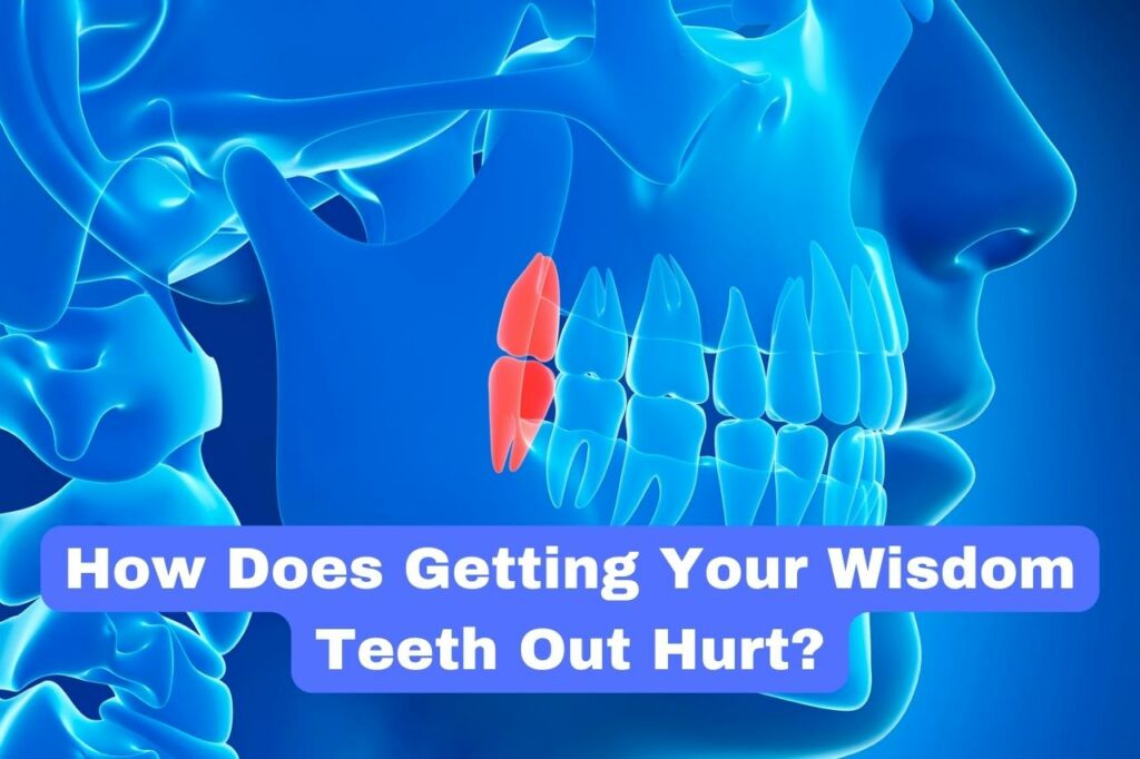 How Does Getting Your Wisdom Teeth Out Hurt?