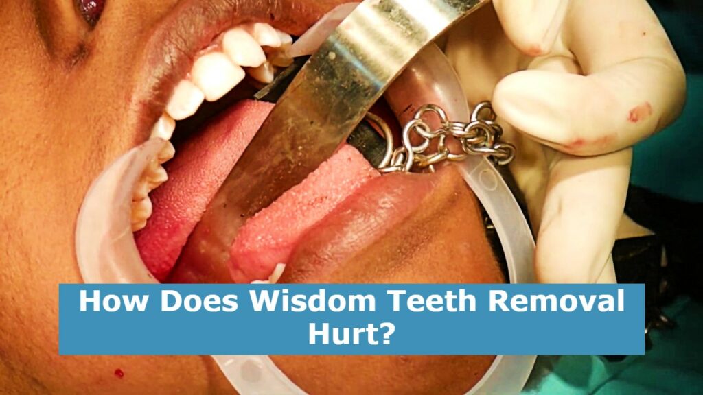 How Does Wisdom Teeth Removal Hurt?