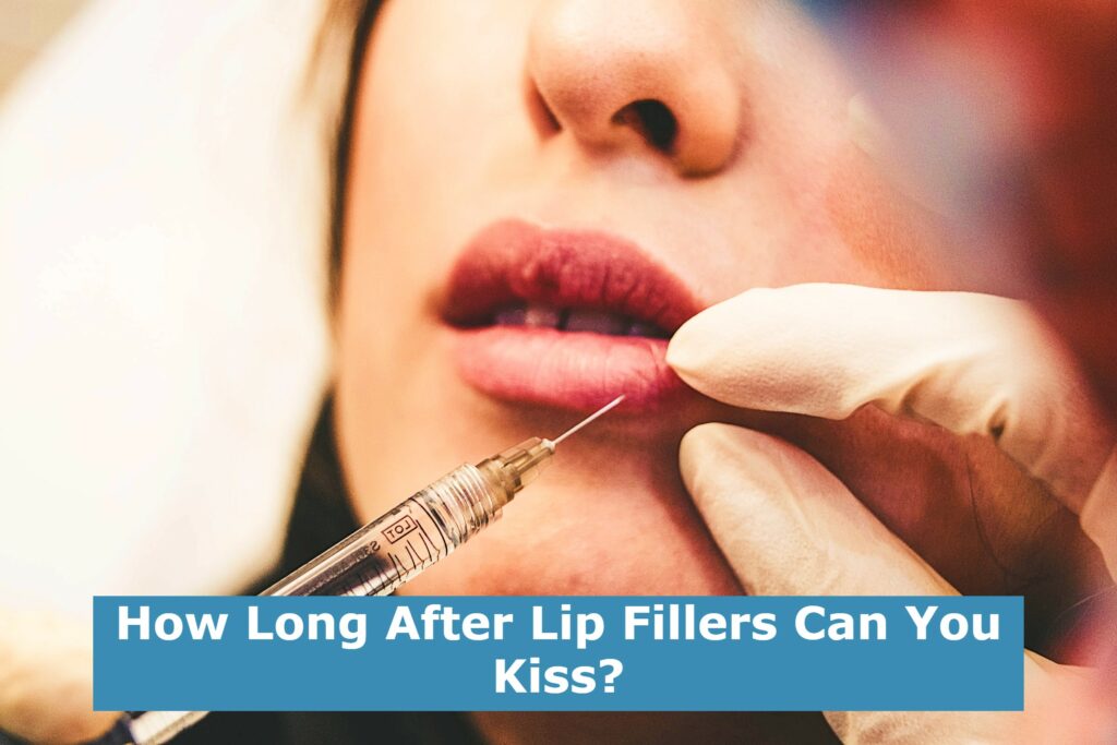 How Long After Lip Fillers Can You Kiss?