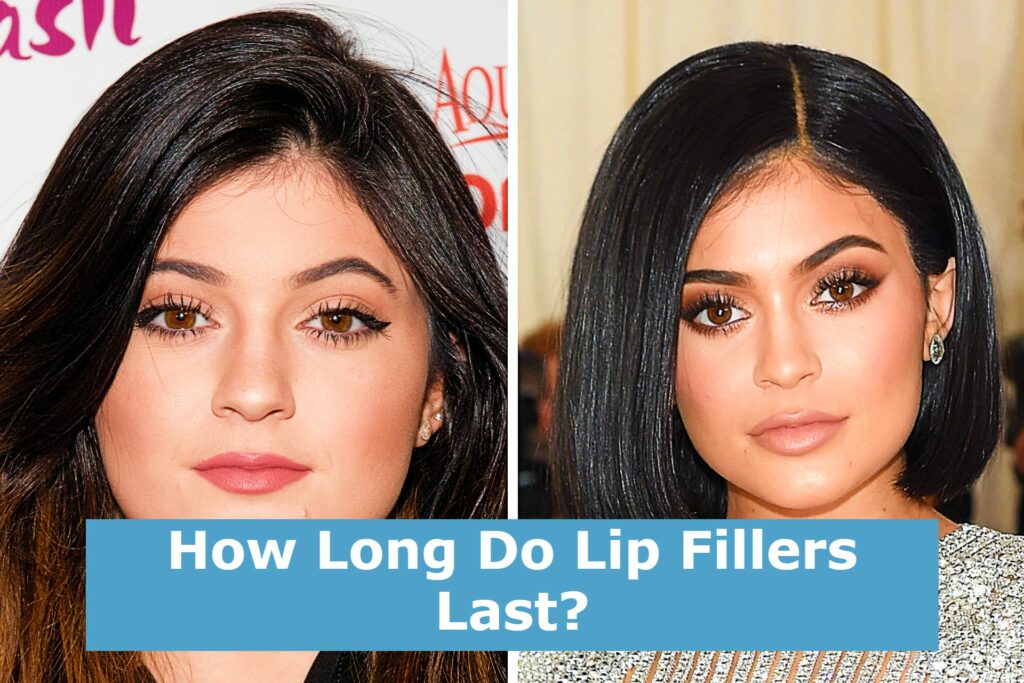 How Long Do Lip Fillers Last?