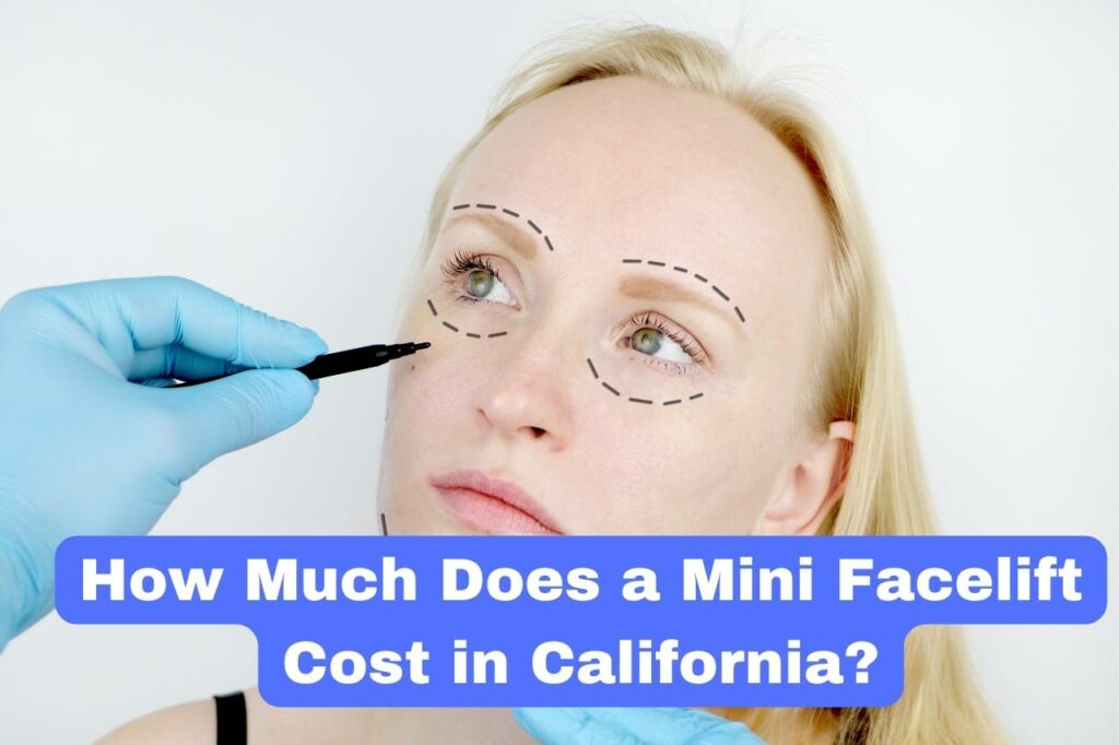 How Much Does a Mini Facelift Cost in California?