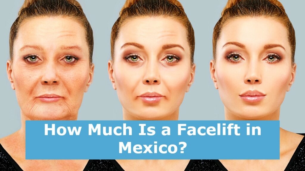 How Much Is a Facelift in Mexico?