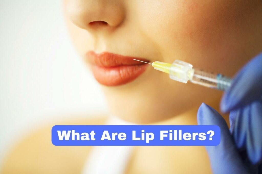 What Are Lip Fillers?