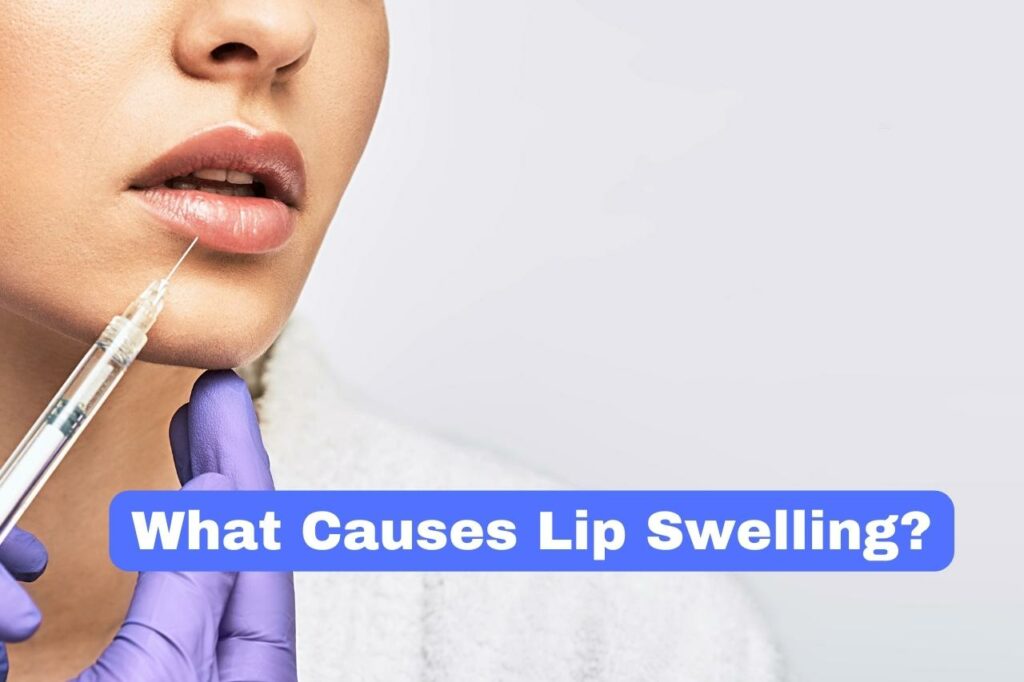 What Causes Lip Swelling?