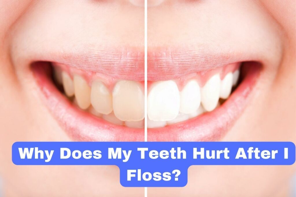 Why Does My Teeth Hurt After I Floss?