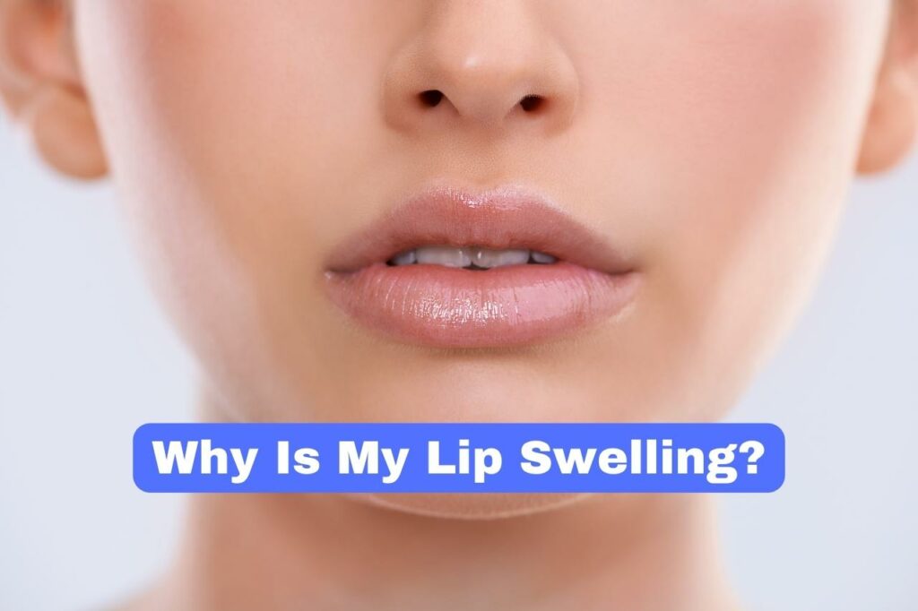 Why Is My Lip Swelling?