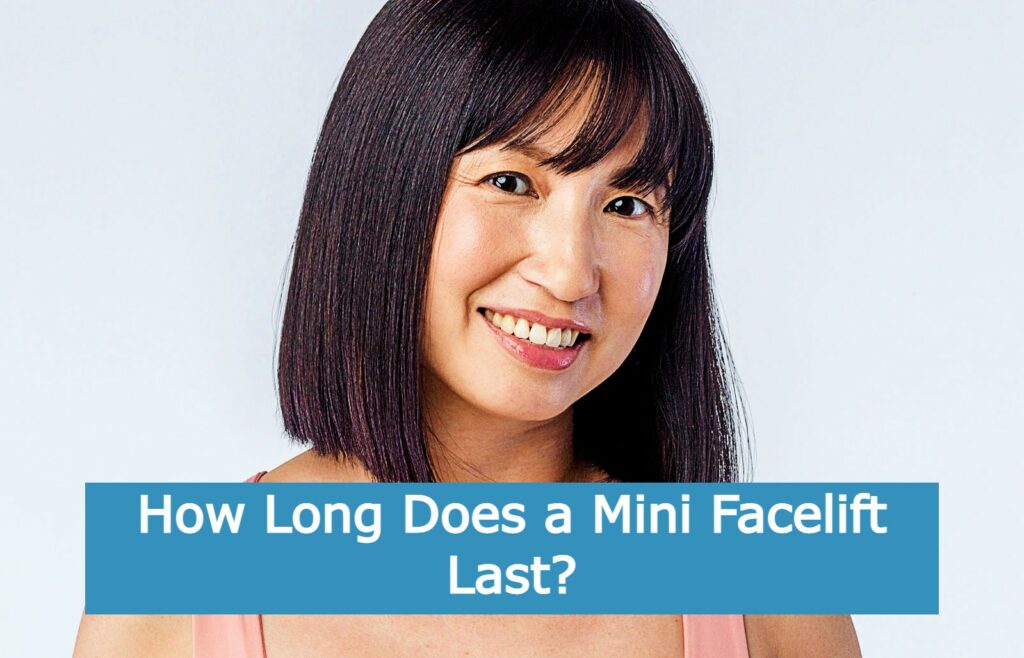 How Long Does a Mini Facelift Last?